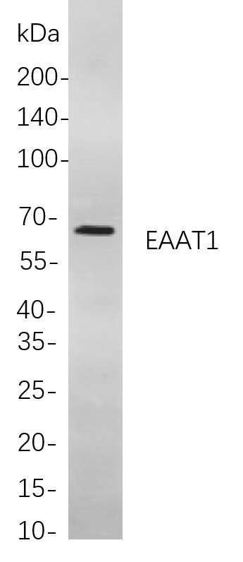 Rabbit Monoclonal Antibody to EAAT1