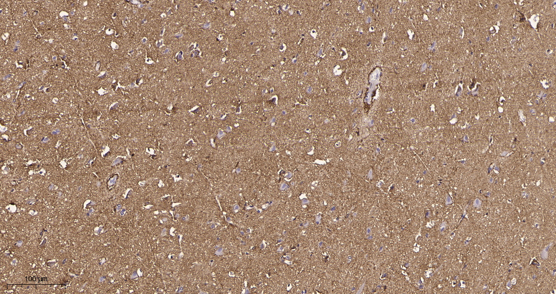 Rabbit Monoclonal Antibody to EAAT1