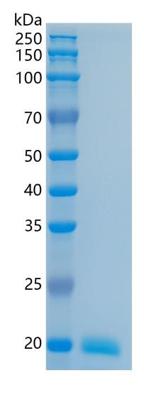 GX00001 Human IL28A