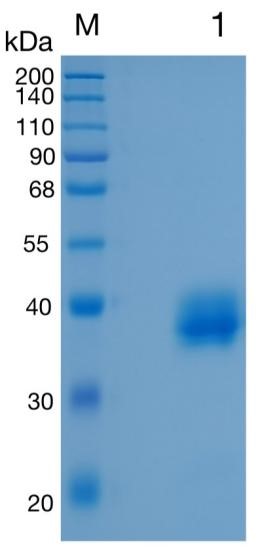 GX00037 Human CA12