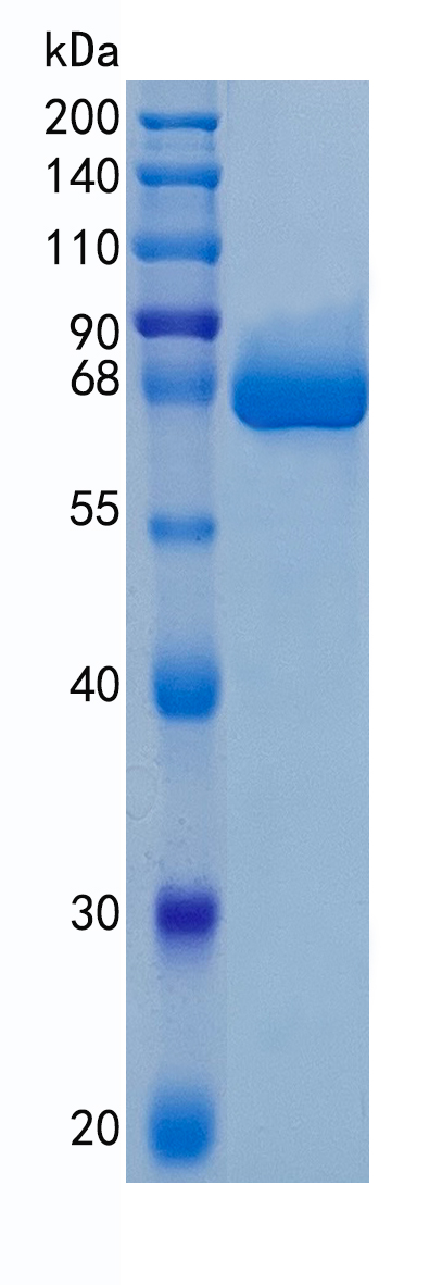 GX00111 Human ALPL