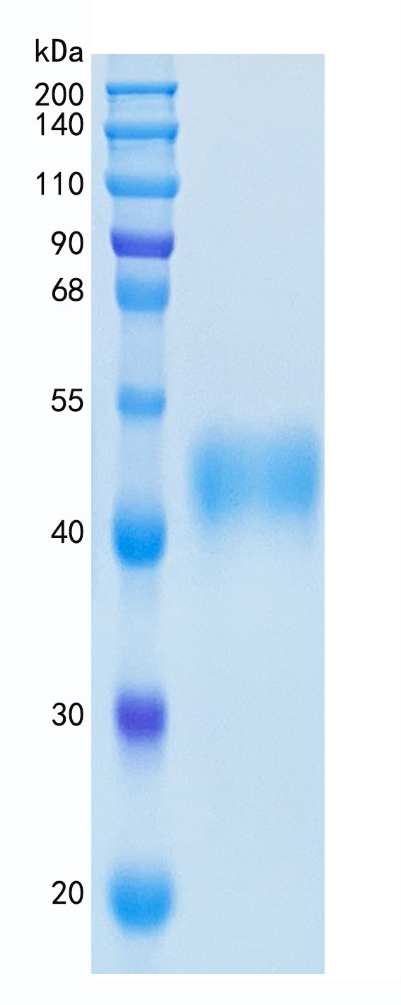 GX00145 Human MCSF