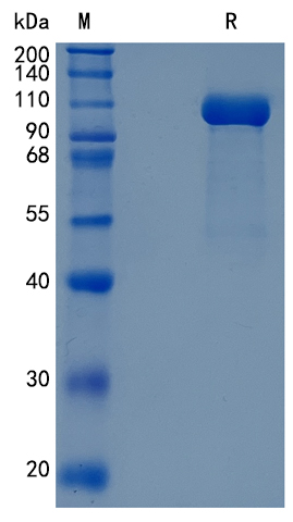 GX00154 Human GAA