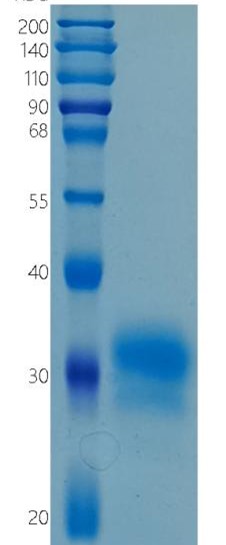 GX00192 Human FOLR1