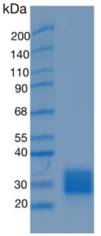 GX00566 Human ULBP1
