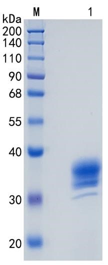 GX00582 Human ASAM