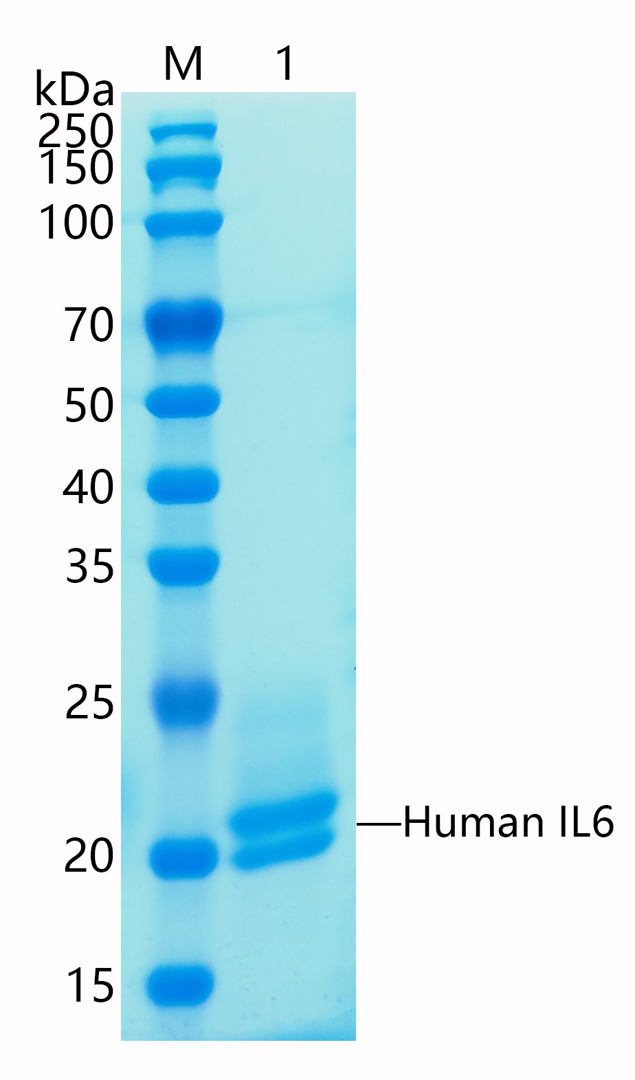 GX00664 Human IL6